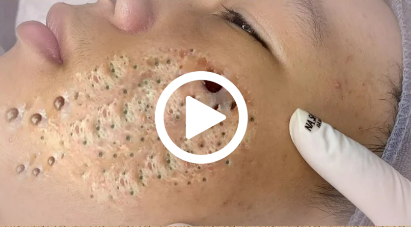 MEU DEUS! Ela Pensou Que Era TUM0R, Mas Na Verdade Olha Só O Que Saiu…