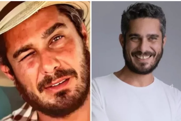 Morte de Thommy Schiavo: Amigo faz revelação inédita sobre antes da queda que tirou a vida do ator